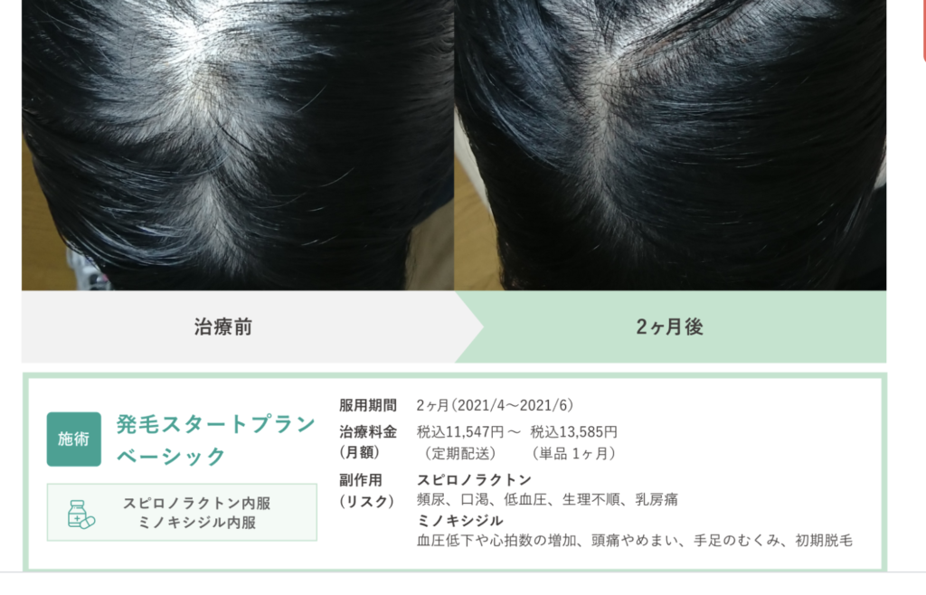 料金・費用|クリニックフォア女性薄毛治療