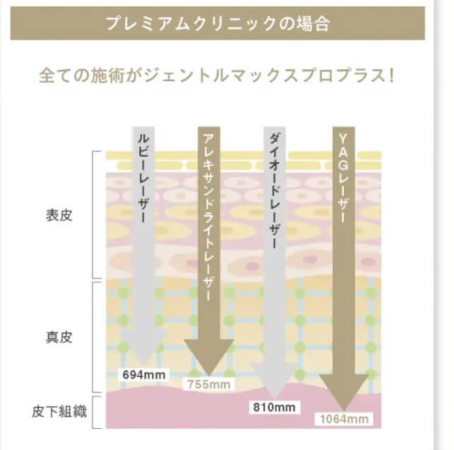 ジェントルマックスプロプラスが必ず使える医療脱毛クリニック｜プレミアムクリニック