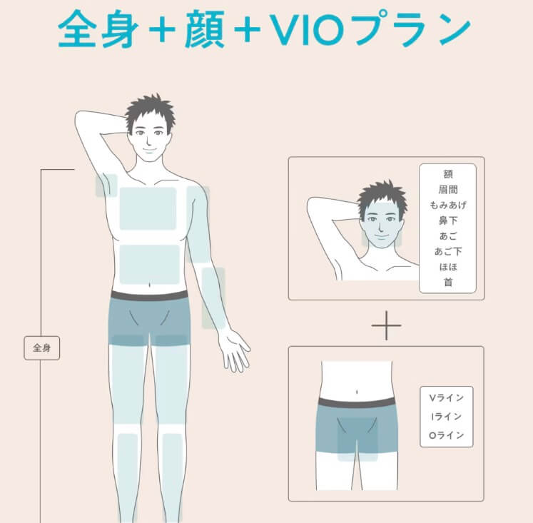 全身＋顔＋VIO料金・費用｜メンズブリリアスキンクリニック