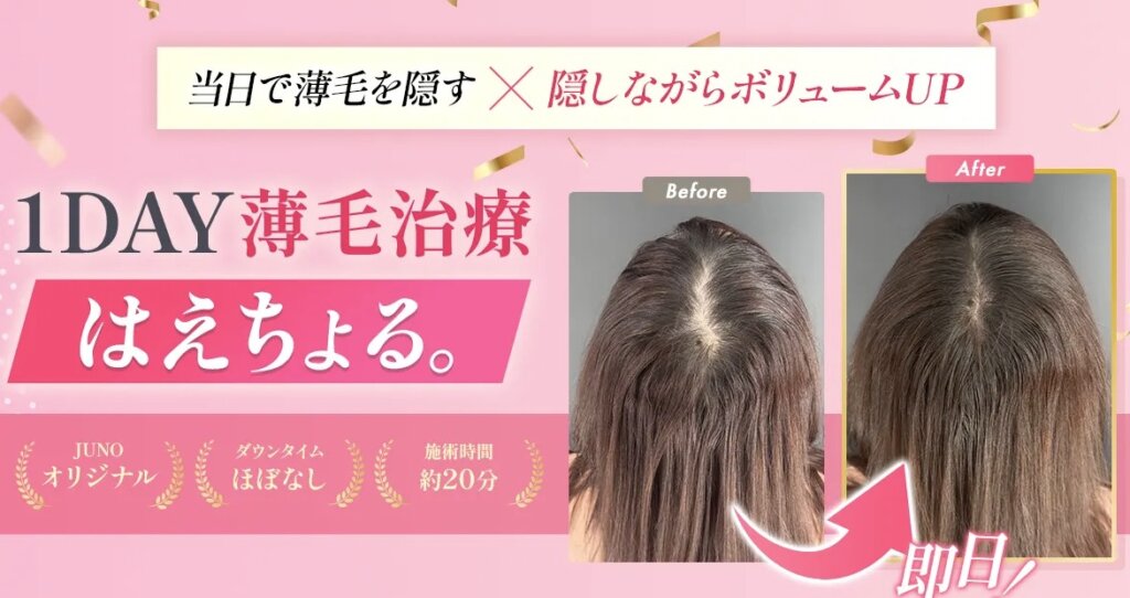 はえちょるは、女性薄毛治療にも効果的